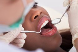 Your Medications Could Cause Adult Tooth Decay