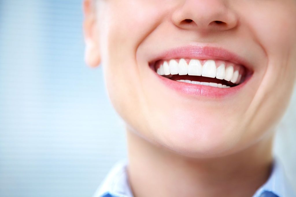 teeth whitening services Truckee California