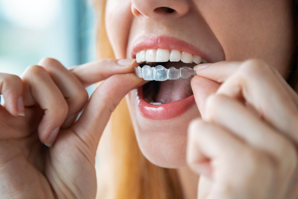 Invisalign and Oral Health