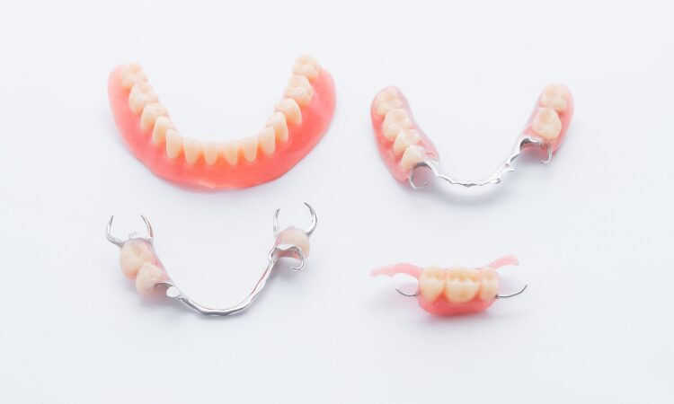 Understanding the differences between a partial denture and a bridge can help you make an informed decision about your dental health.